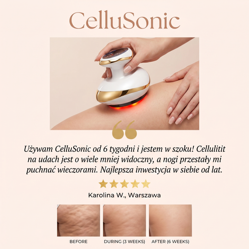 CelluSonic - Opinia klientki